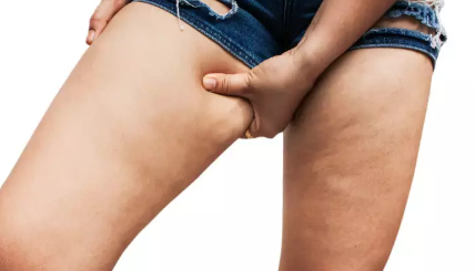 get rid of thigh fat