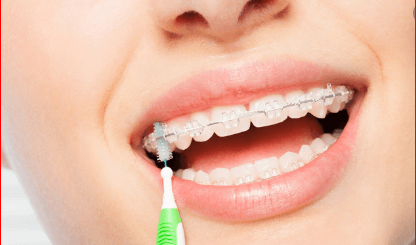 Cavities health