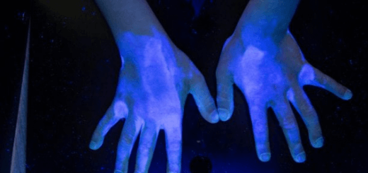 ultraviolet skin